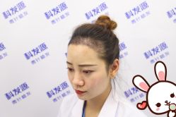 -大麦微针植发丨全国连锁