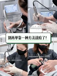 -KISS U 国际美学