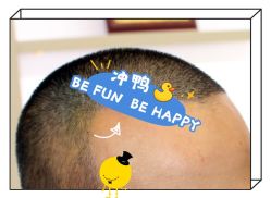 -大麦微针植发全国连锁