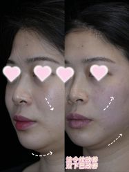 -Yestar重庆艺星医疗美容医院