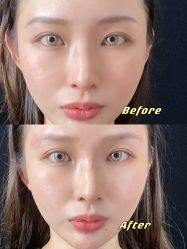 点击看大图 体验前-广州美莱医疗美容医院