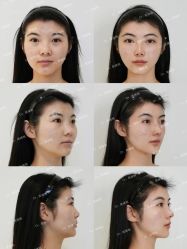 -Yestar艺星医疗美容医院