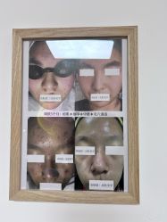 -美肤盾祛痘·问题肌头疗管理中心