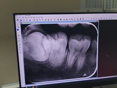 -北京大学口腔医院(第四门诊部)