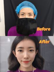 -天津健丽·去眼袋医疗美容机构