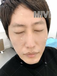 -MIVI半永久纹眉纹绣