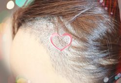 -大麦微针植发全国连锁