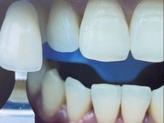 -牙博士口腔品牌连锁(杨浦店)