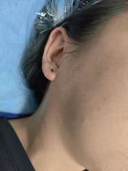 -长沙雅美医疗美容医院