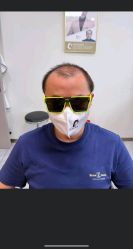 -唐风采假发补发定制