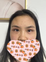 体验后-JS医疗美容