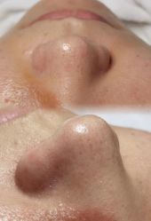 -苑苑vbeauty科技美容SPA