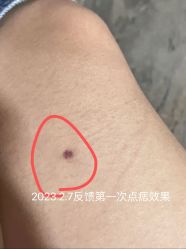 -深圳阳光医疗美容医院·旗舰店