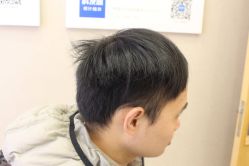 -大麦微针植发丨全国连锁