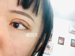 点击看大图 -铂特丽医美·眼鼻整形·光电美肤·注射抗衰