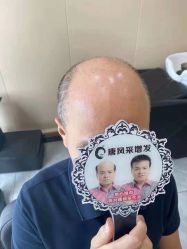 -唐风采假发补发定制