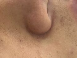 点击看大图 -蕾特恩专业祛痘·皮肤管理