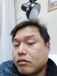 -北京美痣堂古方祛痣斑疣瘊
