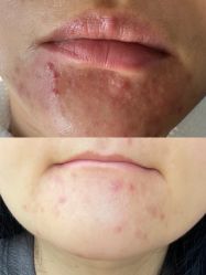 -尊尚柏丽美容SPA