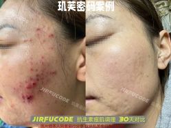 -元熙兰积皮肤管理