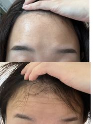 体验后-青岛诺德医学美容医院