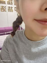 -痣清宫祛斑祛痣连锁店