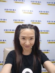 -大麦微针植发丨全国连锁