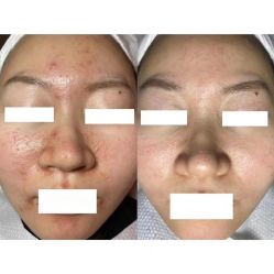 -美肤盾祛痘·问题肌头疗管理中心