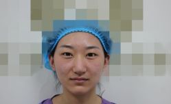 体验前-西安壹加壹医疗美容医院