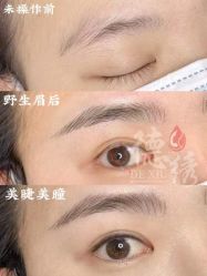 -德绣·机器野生眉发际线·美瞳线半永久