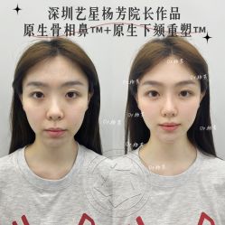 -深圳艺星医疗美容医院