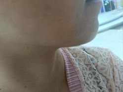 -广州美莱医疗美容医院