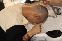 点击看大图 -大麦微针植发丨全国连锁