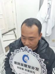 -唐风采假发补发定制