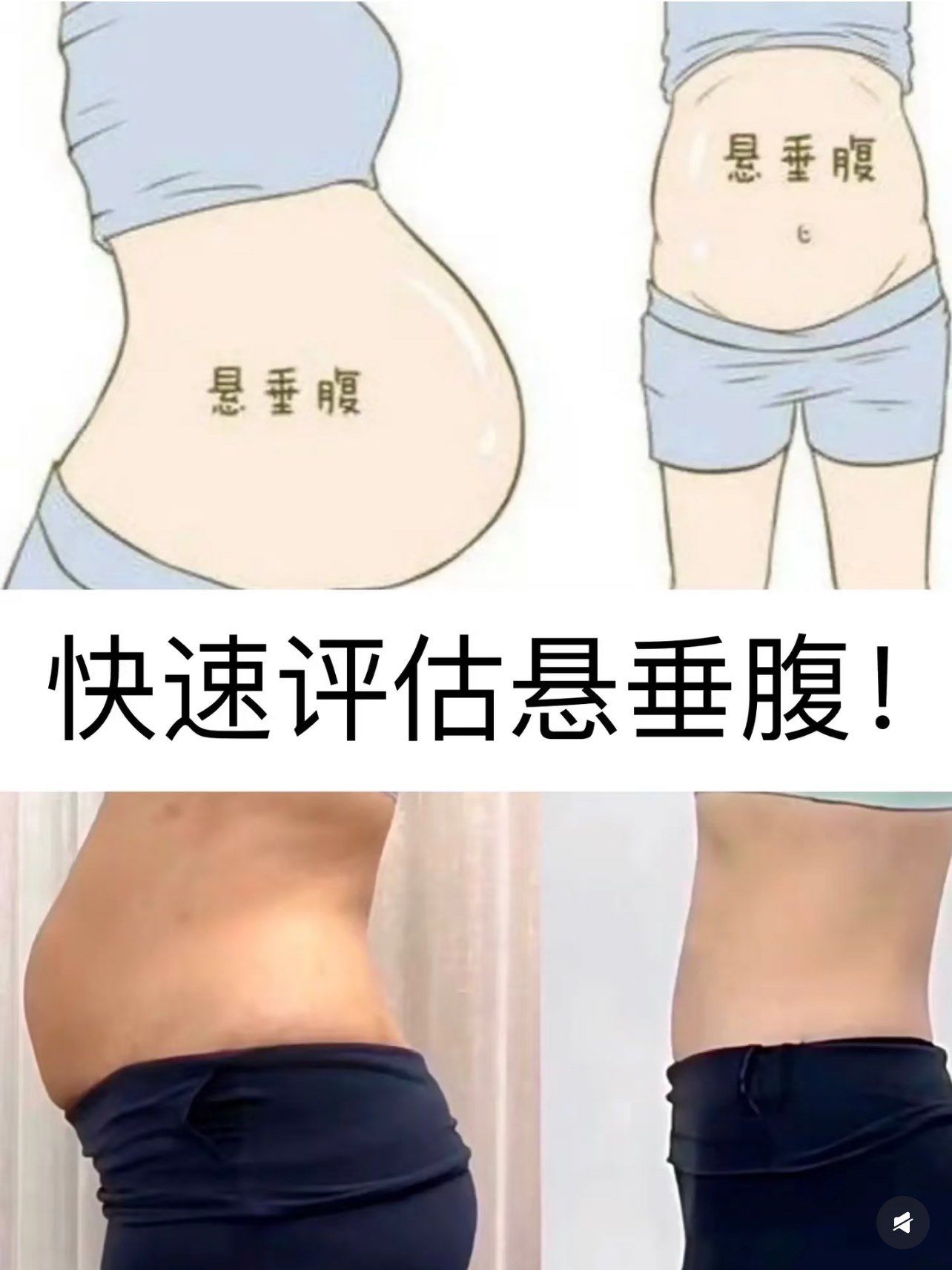 悬垂腹成因?解决方案?练习思路?悬垂腹原因