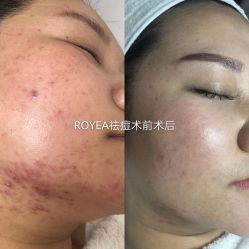 -ROYEA茹彦祛痘·问题肌肤修护中心