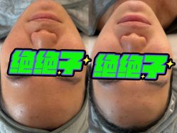 -skin79皮肤管理中心
