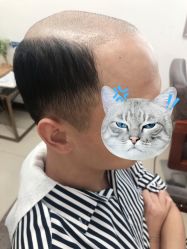 -发饰美男士增发补发假发定制店