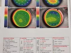 -杭州明视康眼科医院