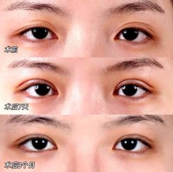 -上海伊莱美医疗美容医院
