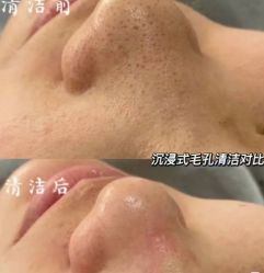 -美愈美肤MEIYU SKIN