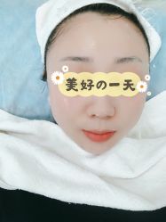 体验后-欧扬医疗美容