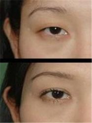 -美莱医学美容医院