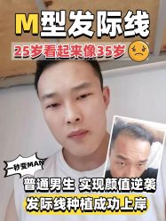 -雍禾植发全国连锁