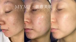 -美愈美肤MEIYU SKIN