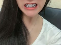 -美酷口腔牙齿矫正(江桥万达店)