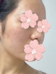 体验后-深圳美莱医疗美容医院