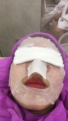 -蕾特恩祛痘•皮肤管理