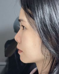 -广州健丽·去眼袋医疗美容机构