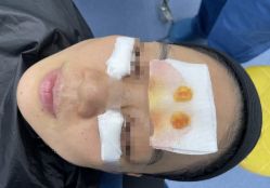 -天津健丽·去眼袋医疗美容机构
